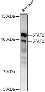 [KO Validated]Anti-STAT2 Antibody, clone 4A5P8, Rabbit Monoclonal