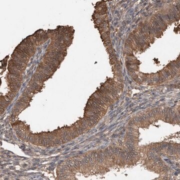 Anti-TRIM5 antibody produced in rabbit Prestige Antibodies&#174; Powered by Atlas Antibodies, affinity isolated antibody, buffered aqueous glycerol solution, Ab1