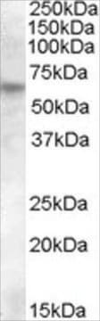 Anti-RPE65 antibody produced in goat affinity isolated antibody, buffered aqueous solution