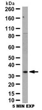 Anti-Galectin-3 Antibody from rabbit, purified by affinity chromatography