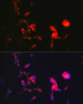 Anti-DKK3 Antibody, clone 1R5E0, Rabbit Monoclonal