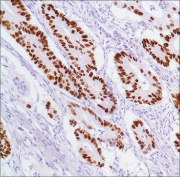 Anti-P53 antibody, Rabbit monoclonal recombinant, expressed in proprietary host, clone SP5, tissue culture supernatant