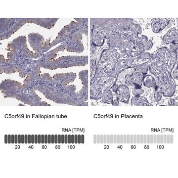 Anti-C5ORF49 antibody produced in rabbit Prestige Antibodies&#174; Powered by Atlas Antibodies, affinity isolated antibody, buffered aqueous glycerol solution