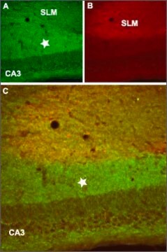 Anti-GABAB Receptor 2 antibody produced in rabbit affinity isolated antibody, lyophilized powder