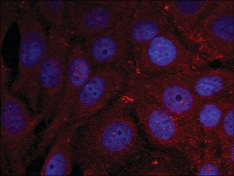 Anti-phospho-SNCA (pTyr136) antibody produced in rabbit affinity isolated antibody