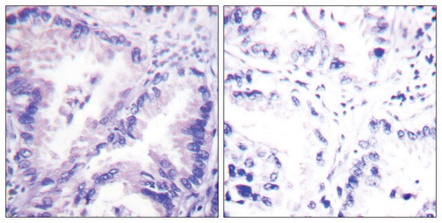 Anti-PP2A-&#945; antibody produced in rabbit affinity isolated antibody