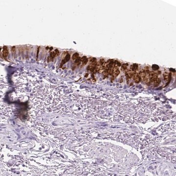 Anti-SCGB1A1 antibody produced in rabbit Prestige Antibodies&#174; Powered by Atlas Antibodies, affinity isolated antibody, buffered aqueous glycerol solution