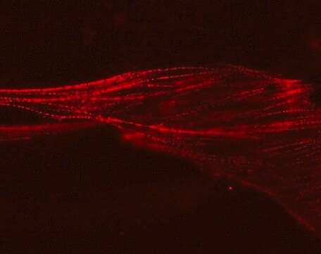 LentiBrite &#945;-actinin-RFP Lentiviral Biosensor