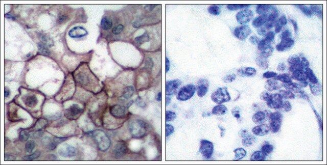 Anti-phospho-EGFR (pTyr1197) antibody produced in rabbit affinity isolated antibody