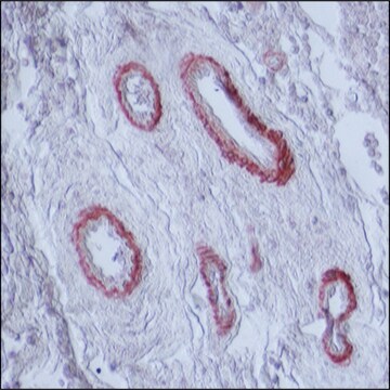 モノクロナール抗ミオシン (平滑筋型) マウス宿主抗体 clone hSM-V, ascites fluid