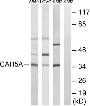 Anti-CA5A antibody produced in rabbit affinity isolated antibody