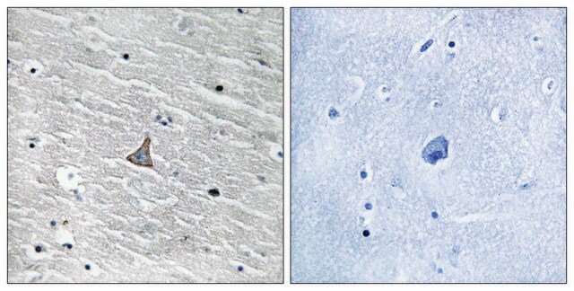 Anti-VHL antibody produced in rabbit affinity isolated antibody