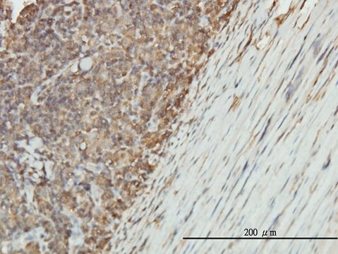 Monoclonal Anti-ENO1 antibody produced in mouse clone 8G8, purified immunoglobulin, buffered aqueous solution