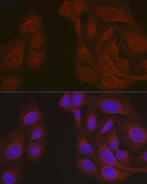 Anti- Notch1 antibody produced in rabbit