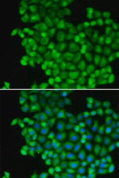 Anti-LDHA antibody produced in rabbit