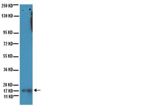 Anti-acetyl-Lysine Antibody, clone 4G12 clone 4G12, Upstate&#174;, from mouse