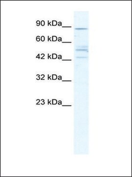 Anti-CHRNB2 (AB1) antibody produced in rabbit IgG fraction of antiserum