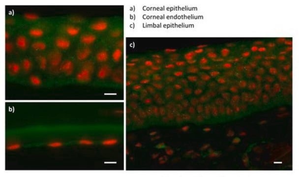 Anti-ZEB1 antibody produced in rabbit affinity isolated antibody