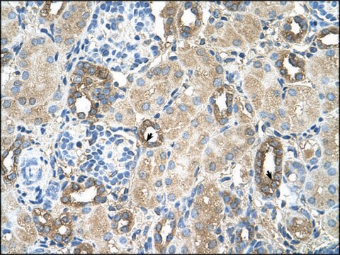 Anti-MGAT2 antibody produced in rabbit IgG fraction of antiserum