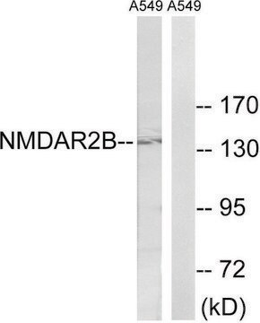 Anti-NMDAR2B antibody produced in rabbit affinity isolated antibody