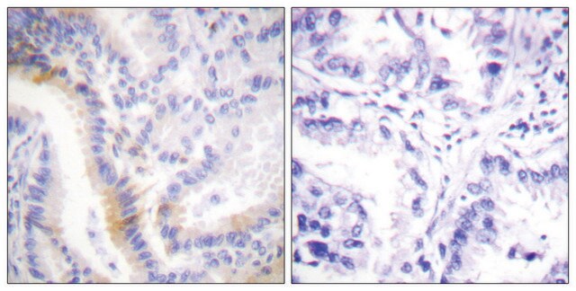 Anti-Urocortin antibody produced in rabbit affinity isolated antibody