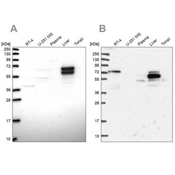 Anti-ACSS3 antibody produced in rabbit Prestige Antibodies&#174; Powered by Atlas Antibodies, affinity isolated antibody, buffered aqueous glycerol solution