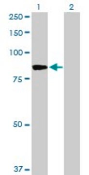 Anti-PFKM antibody produced in rabbit purified immunoglobulin, buffered aqueous solution