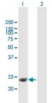 Anti-C1QTNF3 antibody produced in mouse purified immunoglobulin, buffered aqueous solution