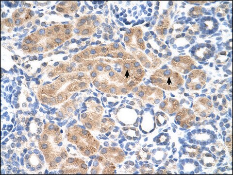 Anti-PDE9A antibody produced in rabbit affinity isolated antibody