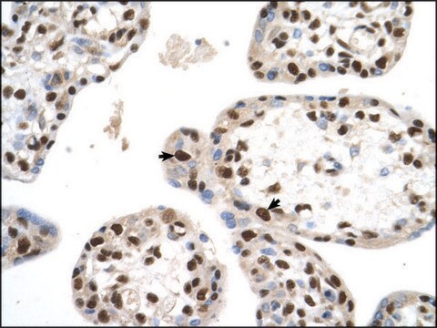 Anti-SETD2 antibody produced in rabbit IgG fraction of antiserum