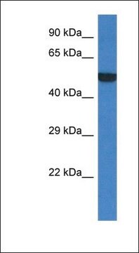 Anti-PORCN antibody produced in rabbit affinity isolated antibody