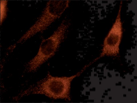 Anti-Rabex-5 (N-terminal) antibody produced in rabbit ~1.0&#160;mg/mL, affinity isolated antibody, buffered aqueous solution