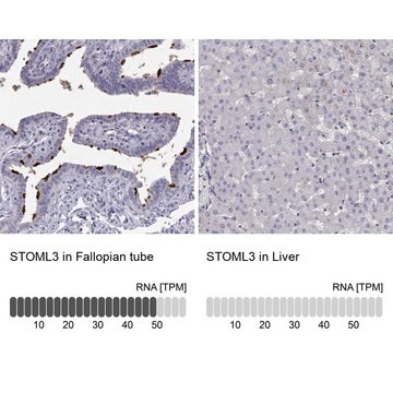 Anti-STOML3 Prestige Antibodies&#174; Powered by Atlas Antibodies, affinity isolated antibody