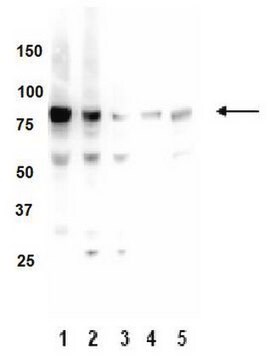 Anti-PKC Antibody (&#945;, &#946;, &#947;), clone M110 clone M110, Upstate&#174;, from mouse