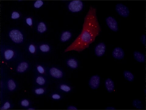 Anti-DCP1A (N-terminal) antibody produced in rabbit ~1.0&#160;mg/mL, affinity isolated antibody, buffered aqueous solution