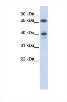 Anti-AGTR1 antibody produced in rabbit affinity isolated antibody