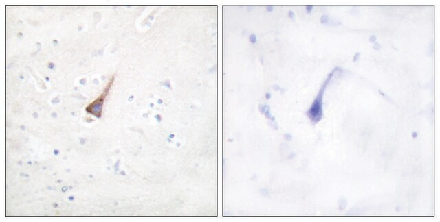 Anti-PTP1B antibody produced in rabbit affinity isolated antibody