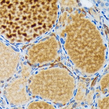 Anti-Thyroid Peroxidase Antibody, clone 3C4A4, Rabbit Monoclonal