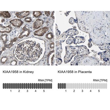 Anti-KIAA1958 antibody produced in rabbit Prestige Antibodies&#174; Powered by Atlas Antibodies, affinity isolated antibody, buffered aqueous glycerol solution