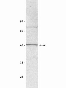 Anti-SUV39H1 Antibody, clone MG44 ascites fluid, clone MG44, Upstate&#174;