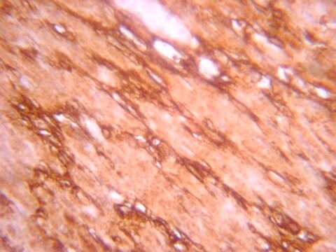 Anti-Notch1 Antibody, Intracellular serum, from rabbit