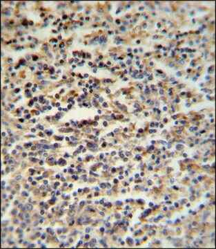 ANTI-SGF29 (C-TERM) antibody produced in rabbit IgG fraction of antiserum, buffered aqueous solution