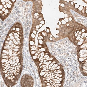 Anti-MIPEP antibody produced in rabbit Prestige Antibodies&#174; Powered by Atlas Antibodies, affinity isolated antibody, buffered aqueous glycerol solution, ab2