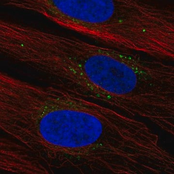 Anti-SYNDIG1 antibody produced in rabbit Prestige Antibodies&#174; Powered by Atlas Antibodies, affinity isolated antibody