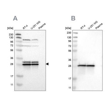 Anti-ETFB antibody produced in rabbit Prestige Antibodies&#174; Powered by Atlas Antibodies, affinity isolated antibody, buffered aqueous glycerol solution, Ab2