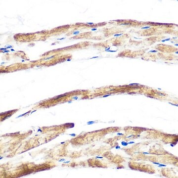 Anti-Fbx32/FBOX32 antibody produced in rabbit