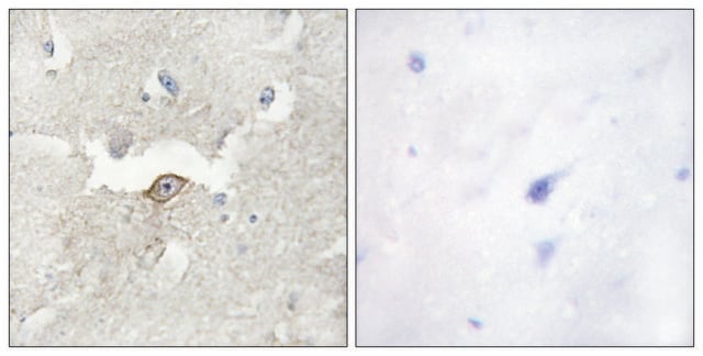 Anti-LMTK2 antibody produced in rabbit affinity isolated antibody