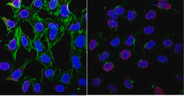 Anti-phospho-ATM (Ser1981) Antibody, clone 10H11.E12, Ascites Free clone 10H11.E12, from mouse