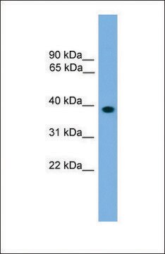 Anti-LHX8, (N-terminal) antibody produced in rabbit affinity isolated antibody