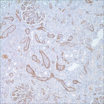 C4d Rabbit Polyclonal Antibody